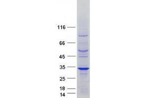 Validation with Western Blot (RIT2 Protein (Myc-DYKDDDDK Tag))