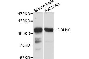 Western blot analysis of extract of mouse brain and rat brain cells, using CDH10 antibody. (CDH10 Antikörper)
