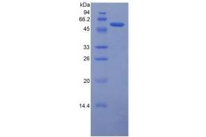 SDS-PAGE analysis of Human Ferroportin Protein. (SLC40A1 Protein)