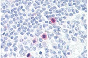 Anti-PLA2G4A antibody IHC staining of human tonsil, mitotic figures. (PLA2G4A Antikörper  (AA 471-520))