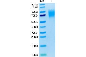 Human SIRP alpha on Tris-Bis PAGE under reduced condition. (SIRPA Protein (AA 32-373) (His tag))