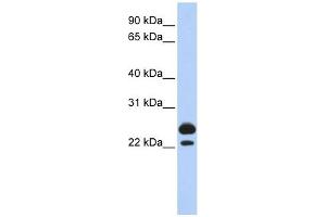 AK1 antibody used at 1 ug/ml to detect target protein. (Adenylate Kinase 1 Antikörper  (Middle Region))