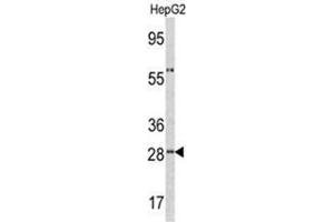 Western blot analysis of ORM1 antibody (C-term) in HepG2 cell line lysates (35ug/lane). (ORM1 Antikörper  (C-Term))