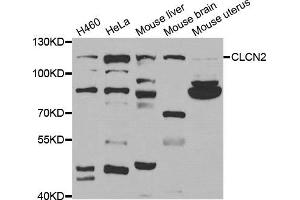 Western Blotting (WB) image for anti-Chloride Channel 2 (CLCN2) antibody (ABIN1877106) (CLCN2 Antikörper)