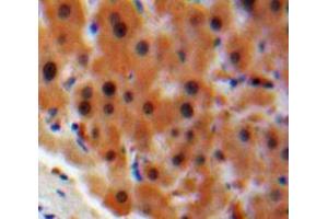 IHC-P analysis of Liver tissue, with DAB staining. (STAT2 Antikörper  (AA 616-849))