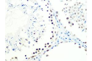 Immunohistochemistry of paraffin-embedded mouse testis using DKC1 Rabbit mAb (ABIN7266869) at dilution of 1:100 (40x lens). (DKC1 Antikörper)