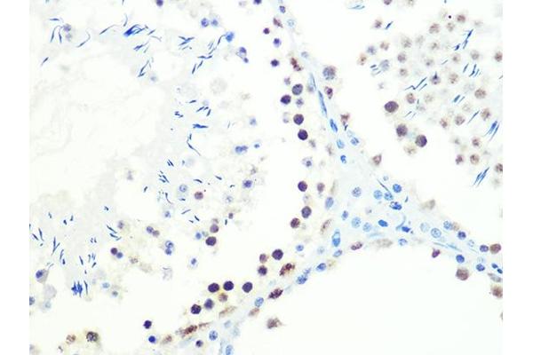 DKC1 Antikörper