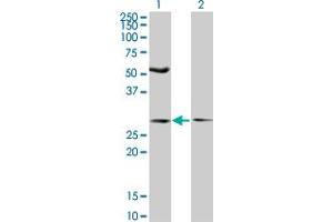 Western Blot analysis of IFT57 expression in transfected 293T cell line by IFT57 monoclonal antibody (M04), clone 3G4. (IFT57 Antikörper  (AA 214-312))