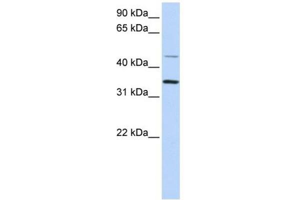 CLN6 Antikörper  (C-Term)
