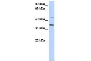 CLN6 antibody used at 1 ug/ml to detect target protein. (CLN6 Antikörper  (C-Term))