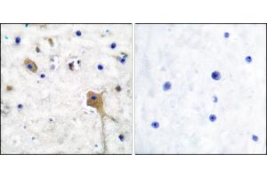 Immunohistochemical analysis of paraffin-embedded human brain tissue using SH-PTP2 antibody. (PTPN11 Antikörper)