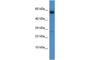 Host: Rabbit Target Name: CASP10 Sample Type: HCT15 Whole Cell lysates Antibody Dilution: 1. (Caspase 10 Antikörper  (C-Term))
