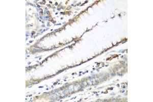 Immunohistochemistry of paraffin-embedded human stomach using CAD antibody (ABIN5974557) at dilution of 1/100 (40x lens). (CAD Antikörper)