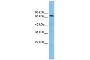Image no. 1 for anti-A Kinase (PRKA) Anchor Protein 10 (AKAP10) (AA 575-624) antibody (ABIN6744510) (AKAP10 Antikörper  (AA 575-624))