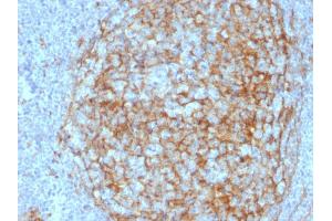 Formalin-fixed, paraffin-embedded human Lymph Node stained with CD14 Mouse Monoclonal Antibody (LPSR/2408). (CD14 Antikörper  (AA 25-148))