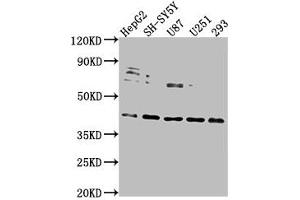 Western Blotting (WB) image for anti-Leucine-Rich Repeats and Transmembrane Domains 2 (LRTM2) (AA 36-310) antibody (ABIN7158062)