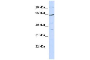Human 293T; WB Suggested Anti-TCF7L1 Antibody Titration: 0. (TCF7L1 Antikörper  (N-Term))