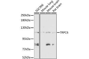 Western blot analysis of extracts of various cell lines, using TRPC6 antibody (ABIN7270918) at 1:1000 dilution.