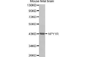 Western Blotting (WB) image for anti-Neuropeptide Y Receptor Y1 (NPY1R) antibody (ABIN3017402) (NPY1R Antikörper)