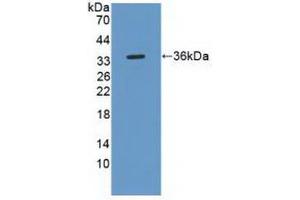 Western blot analysis of recombinant Human ROS1. (ROS1 Antikörper  (AA 1945-2222))