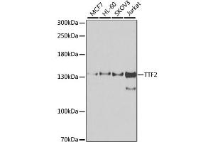 Western blot analysis of extracts of various cell lines, using TTF2 antibody. (TTF2 Antikörper)