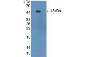 Detection of Recombinant ADIPOR2, Human using Polyclonal Antibody to Adiponectin Receptor 2 (ADIPOR2) (Adiponectin Receptor 2 Antikörper  (AA 2-155))