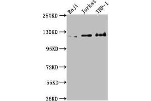Western Blot Positive WB detected in: Raji whole cell lysate, Jurkat whole cell lysate, THP-1 whole cell lysate All lanes: MICAL1 antibody at 1:2000 Secondary Goat polyclonal to rabbit IgG at 1/50000 dilution Predicted band size: 118, 109, 38, 120 kDa Observed band size: 120 kDa (MICAL1 Antikörper  (AA 806-1067))