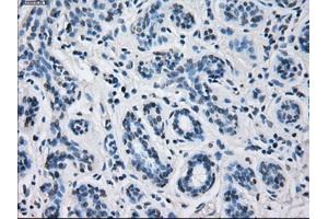 Immunohistochemical staining of paraffin-embedded breast tissue using anti-CYP2E1 mouse monoclonal antibody. (CYP2E1 Antikörper)