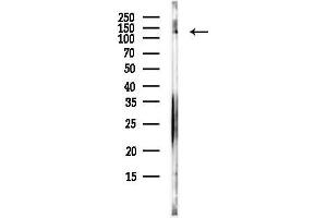anti-Ubiquitin Specific Peptidase 10 (USP10) (N-Term) antibody
