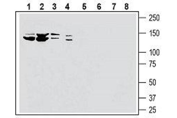 SLC28A3 Antikörper  (5th Extracellular Loop)