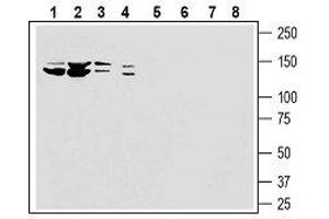 Western blot analysis of human HL-60 myelocytic leukemia cell line lysate (lanes 1 and 5), human K562 chronic myelogenous leukemia cell line lysate (lanes 2 and 6), human MCF-7 breast adenocarcinoma cell line lysate (lanes 3 and 7) and human PANC-1 pancreatic carcinoma cell line lysate (lanes 4 and 8): - 1-4. (SLC28A3 Antikörper  (5th Extracellular Loop))