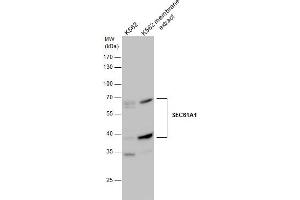 WB Image SEC61A1 antibody detects SEC61A1 protein by western blot analysis. (SEC61A1 Antikörper  (C-Term))