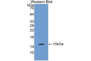 Detection of Recombinant LHb, Rat using Monoclonal Antibody to Luteinizing Hormone Beta Polypeptide (LHb) (LHB Antikörper  (AA 21-141))