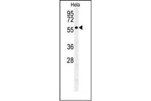 Western blot analysis of GALNT4 Antibody (N-term) in Hela cell line lysates (35ug/lane). (GALNT4 Antikörper  (N-Term))