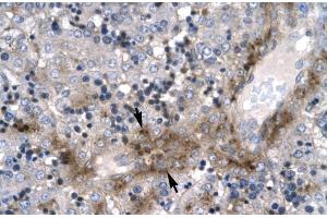 Human Liver; Rabbit Anti-ZNF365 Antibody. (ZNF365 Antikörper  (N-Term))