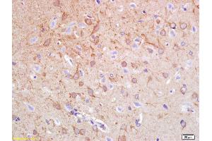 Formalin-fixed and paraffin embedded rat brain labeled with Anti-Synphilin-1 Polyclonal Antibody, Unconjugated (ABIN736163) at 1:200 followed by conjugation to the secondary antibody and DAB staining.