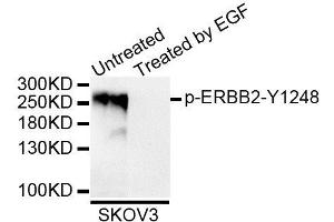 Western blot analysis of extracts of SKOV3 cell line, using Phospho-ERBB2-Y1248 antibody (ABIN5995620). (ErbB2/Her2 Antikörper  (pTyr1248))