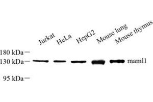 Western blot analysis of maml1 (ABIN7074560) at dilution of 1: 500 (MAML1 Antikörper)