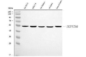 Western blot analysis of SEPT6/SEPTIN6 using anti-SEPT6/SEPTIN6 antibody (ABIN7599390).