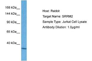 Host: Rabbit Target Name: SRRM2 Sample Tissue: Human Jurkat Whole Cell Antibody Dilution: 1ug/ml
