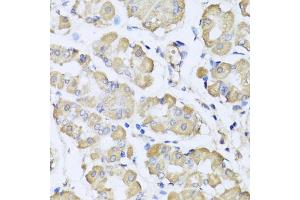 Immunohistochemistry of paraffin-embedded human stomach using L2HGDH antibody (ABIN5975242) at dilution of 1/100 (40x lens). (L2HGDH Antikörper)