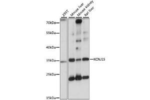 Western blot analysis of extracts of various cell lines, using KCNJ15 antibody. (KCNJ15 Antikörper)