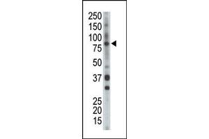 Image no. 1 for anti-BMX Non-Receptor Tyrosine Kinase (BMX) (Middle Region) antibody (ABIN359973) (BMX Antikörper  (Middle Region))