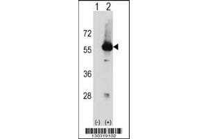 Western blot analysis of Stk3 using rabbit polyclonal Mouse Stk3 Antibody using 293 cell lysates (2 ug/lane) either nontransfected (Lane 1) or transiently transfected (Lane 2) with the Stk3 gene. (STK3 Antikörper  (C-Term))