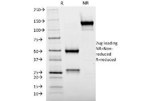 SDS-PAGE Analysis Purified Cytochrome p450 Mouse Monoclonal Antibody (M12P4H2). (CYP2E1 Antikörper  (C-Term))