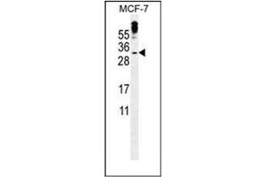 Western blot analysis of MBD3L3 Antibody (C-term) in MCF-7 cell line lysates (35ug/lane). (MBD3L3 Antikörper  (C-Term))