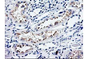 Immunohistochemistry (IHC) image for anti-Cyclin-Dependent Kinase Inhibitor 3 (CDKN3) antibody (ABIN1497459) (CDKN3 Antikörper)