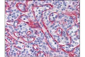 Human Spleen: Formalin-Fixed, Paraffin-Embedded (FFPE) (STAU1/Staufen Antikörper  (C-Term))