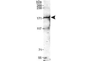 Western blot analysis of Trpm2 in mouse brain membrane lysates with Trpm2 polyclonal antibody . (TRPM2 Antikörper  (AA 1200-1300))