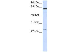 Western Blotting (WB) image for anti-Transmembrane Protein 138 (TMEM138) antibody (ABIN2459085)